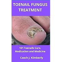 TOENAIL FUNGUS TREATMENT: 101 Toenails Cure, Medication and Medicine TOENAIL FUNGUS TREATMENT: 101 Toenails Cure, Medication and Medicine Paperback Kindle