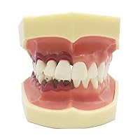 Dental Oral Periodontal Pathology Model, Disease Classification Tooth Model, Dental Care Research Model, Doctor-Patient Teaching Model