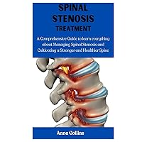 SPINAL STENOSIS TREATMENT: A Comprehensive Guide to learn everything about Managing Spinal Stenosis and Cultivating a Stronger and Healthier Spine SPINAL STENOSIS TREATMENT: A Comprehensive Guide to learn everything about Managing Spinal Stenosis and Cultivating a Stronger and Healthier Spine Hardcover Kindle Paperback