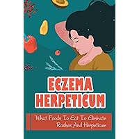 Eczema Herpeticum: What Foods To Eat To Eliminate Rashes And Herpeticum