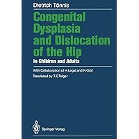 Congenital Dysplasia and Dislocation of the Hip in Children and Adults Congenital Dysplasia and Dislocation of the Hip in Children and Adults Paperback
