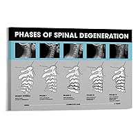 Spinal Degeneration Level Chart Demonstration Chart Spinal Subluxation Art Poster (5) Canvas Poster Bedroom Decor Office Room Decor Gift Frame-style 12x08inch(30x20cm)