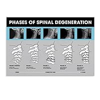 HWGACS Chiropractic Subluxation Degeneration Stage Poster Spine Hospital Decoration Poster (1) Home Living Room Bedroom Decoration Gift Printing Art Poster Unframe-style 24x16inch(60x40cm)