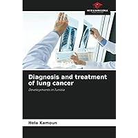 Diagnosis and treatment of lung cancer: Developments in Tunisia