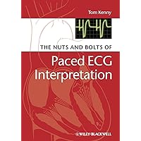 The Nuts and bolts of Paced ECG Interpretation The Nuts and bolts of Paced ECG Interpretation Paperback Kindle