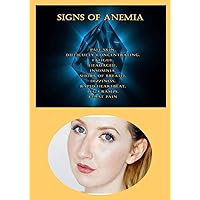 Signs of Anemia: Pale Skin, Difficulty Concentrating, Fatigue, Headache, Insomnia, Short of Breath, Dizziness, Rapid Heartbeat, Leg Cramps, Chest Pain