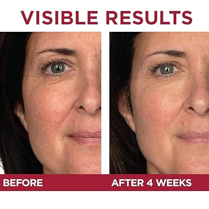 L'Oreal Paris Revitalift Triple Power Anti-Aging Eye Cream Treatment, with Pro Retinol, Hyaluronic Acid & Vitamin C to Reduce Wrinkles, De-puff and Brighten Skin, 0.5 fl. oz.