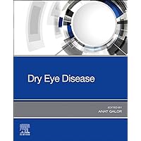 Dry Eye Disease Dry Eye Disease Paperback Kindle