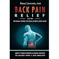 Back Pain Relief and the Spinal Cord Stimulator Implant: How I went from a back injury to relief with a Spinal Cord Stimulator implant Back Pain Relief and the Spinal Cord Stimulator Implant: How I went from a back injury to relief with a Spinal Cord Stimulator implant Paperback Kindle