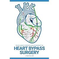 Your Simply Marvelous Roadmap to Heart Bypass Surgery Your Simply Marvelous Roadmap to Heart Bypass Surgery Paperback Kindle Hardcover