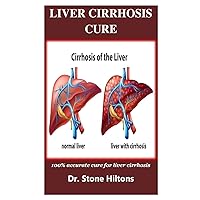 Liver Cirrhosis Cure: 100% accurate cure for liver cirrhosis