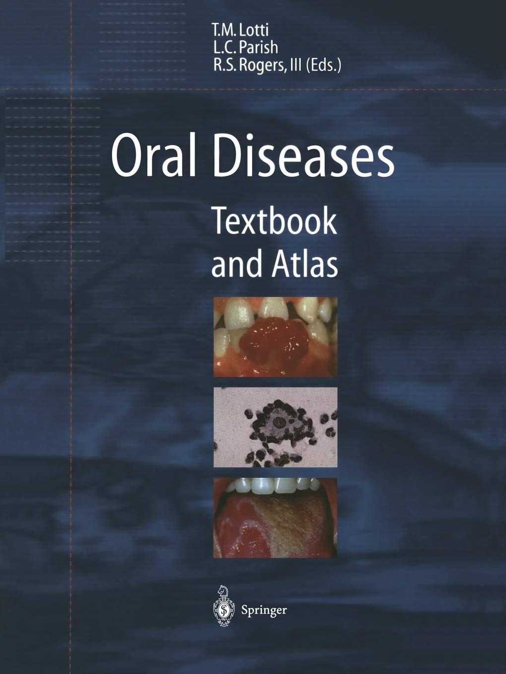 Oral Diseases: Textbook and Atlas