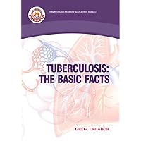Tuberculosis: The Basic Facts Tuberculosis: The Basic Facts Kindle