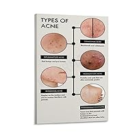 CSXCLYA Identify The Type of Acne And How to Treat Acne Skin Knowledge Poster (2) Wall Poster Art Canvas Printing Poster Office Bedroom Aesthetic Poster Frame-style 08x12inch(20x30cm)