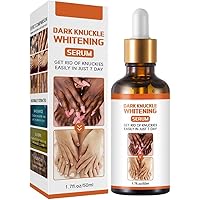 Acanthosis Nigricans Therapy Oil, Acanthosis Nigricans Treatment Lightening Serum, Black Spot Correction Oil, 50ml Knee and Elbow Lightening Oil (2 Bottle)
