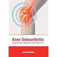 Knee Osteoarthritis: Assessment, Diagnosis and Treatment Knee Osteoarthritis: Assessment, Diagnosis and Treatment Hardcover