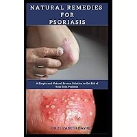 NATURAL REMEDIES FOR PSORIASIS: A Simple and Natural Proven Solution to Get Rid of Your Skin Problem : Dermatitis, Eczema, Psoriasis & Rosacea and Others NATURAL REMEDIES FOR PSORIASIS: A Simple and Natural Proven Solution to Get Rid of Your Skin Problem : Dermatitis, Eczema, Psoriasis & Rosacea and Others Paperback Kindle