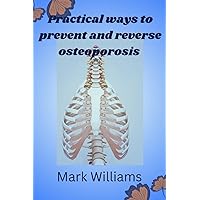 Practical ways to prevent and reverse osteoporosis: Osteoporosis prevention guide, diet book, Safe and Effective Exercise for osteoporosis Practical ways to prevent and reverse osteoporosis: Osteoporosis prevention guide, diet book, Safe and Effective Exercise for osteoporosis Paperback Kindle