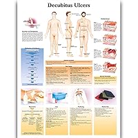 Decubitus Ulcers Anatomy Posters for Walls Nursing Students Educational Anatomical Poster Chart Waterproof Canvas Medicine Disease Map for Doctor Enthusiasts Kid's Enlightenment Education (Decubitus Ulcers, 20x30inches)