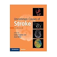 Uncommon Causes of Stroke Uncommon Causes of Stroke Hardcover eTextbook