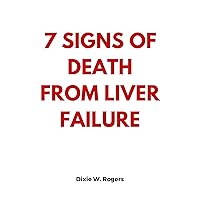 7 Signs Of Death From Liver Failure