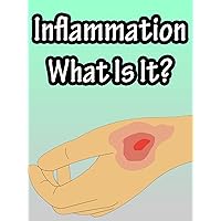 Inflammation, What Is It?