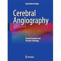 Cerebral Angiography: Normal Anatomy and Vascular Pathology Cerebral Angiography: Normal Anatomy and Vascular Pathology Hardcover Kindle