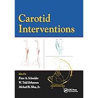 Carotid Interventions Carotid Interventions Paperback Kindle Hardcover