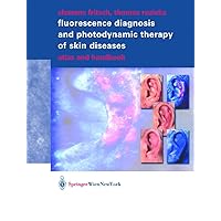 Fluorescence Diagnosis and Photodynamic Therapy of Skin Diseases: Atlas and Handbook Fluorescence Diagnosis and Photodynamic Therapy of Skin Diseases: Atlas and Handbook Hardcover Kindle Paperback