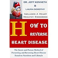 HOW TO REVERSE HEART DISEASE: The Secret and Proven Method of Preventing and Reversing Heart Disease Based on Nutrition and Lifestyle (Includes a Heart Healthy Cookbook) HOW TO REVERSE HEART DISEASE: The Secret and Proven Method of Preventing and Reversing Heart Disease Based on Nutrition and Lifestyle (Includes a Heart Healthy Cookbook) Kindle Paperback