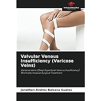 Valvular Venous Insufficiency (Varicose Veins): Varicose Veins (Deep Superficial Venous Insufficiency) Minimally Invasive Surgical Treatment
