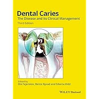 Dental Caries: The Disease and its Clinical Management Dental Caries: The Disease and its Clinical Management Hardcover