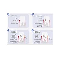 Infographic Poster of 4 Stages of Periodontal Disease Progression Oral Health Caries Poster Canvas Painting Posters And Prints Wall Art Pictures for Living Room Bedroom Decor 08x12inch(20x30cm) Unfra