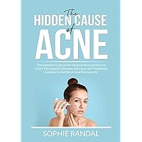 The Hidden Cause of Acne: The Essential Guide on the Cause of Acne and How to Cure it Permanently, Discover the Cause and Treatments Available to Get Rid of Acne Permanently