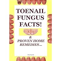 Nail Fungus Facts!: & Proven Home Remedies