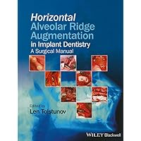 Horizontal Alveolar Ridge Augmentation in Implant Dentistry: A Surgical Manual Horizontal Alveolar Ridge Augmentation in Implant Dentistry: A Surgical Manual Hardcover