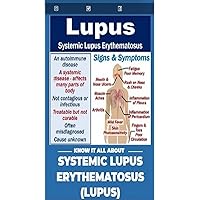 Systemic Lupus Erythematosus (Lupus): The Chronic Autoimmune Disease Affecting Multiple Systems of the Body