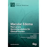 Macular Edema: The Current Recommendations for Clinical Practice
