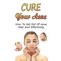 Cure Your Acne: How To Get Rid Of Acne Fast And Effectively