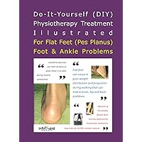 Physiotherapy Treatment Illustrated For Flat Feet (Pes Planus) Foot & Ankle Problems Physiotherapy Treatment Illustrated For Flat Feet (Pes Planus) Foot & Ankle Problems Paperback