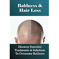 Baldness & Hair Loss: Discover Essential Treatments & Solutions To Overcome Baldness: How To Prevent Hair Loss For Guys