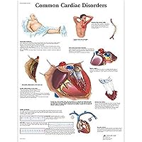 3B Scientific VR1343UU Glossy Paper Common Cardiac Disorders Anatomical Chart, Poster Size 20