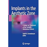 Implants in the Aesthetic Zone: A Guide for Treatment of the Partially Edentulous Patient Implants in the Aesthetic Zone: A Guide for Treatment of the Partially Edentulous Patient Kindle Hardcover