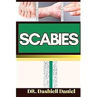 SCABIES: Expert Guide To Understanding Scabies Causes, Symptoms, Preventing, Treatment for optimal wellness SCABIES: Expert Guide To Understanding Scabies Causes, Symptoms, Preventing, Treatment for optimal wellness Paperback Kindle