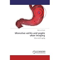 Ulcerative colitis and peptic ulcer imaging: Ulcer and Imaging