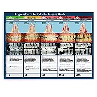 STAGES OF PERIODONTAL DISEASE Several Cycles of Periodontal Disease in Dentistry Knowledge Chart Poster (1) Canvas Poster Wall Art Decor Print Picture Paintings for Living Room Bedroom Decoration Unfr