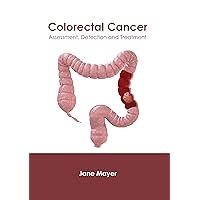 Colorectal Cancer: Assessment, Detection and Treatment Colorectal Cancer: Assessment, Detection and Treatment Hardcover
