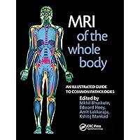 MRI of the Whole Body: An Illustrated Guide for Common Pathologies MRI of the Whole Body: An Illustrated Guide for Common Pathologies Kindle Paperback