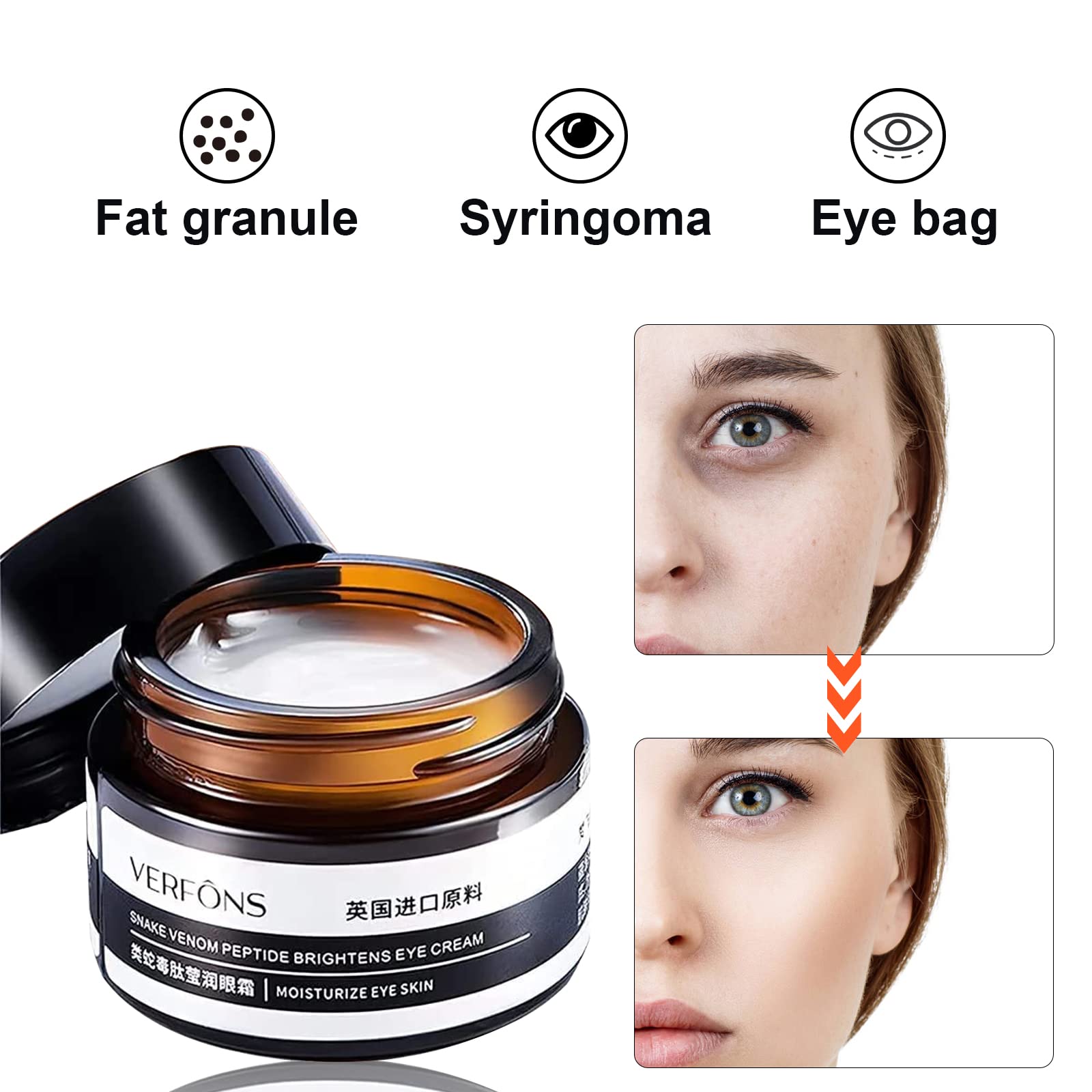 Verfons Firming Eye Cream,Verfons Snake Venom Firming Eye Cream, Verfons Temporary Firming Eye Cream for Bags, Anti Aging Eye Bag Cream, Instant Remove Eye Bags Fades Fine Lines and Wrinkles-2pcs…