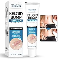 Keloid Bump Removal, Effective Scar Cream for Scar Removal, Works for Acne Scar, Burn Scar, C-Section Scar, Stretch Mark & Surgical Scar